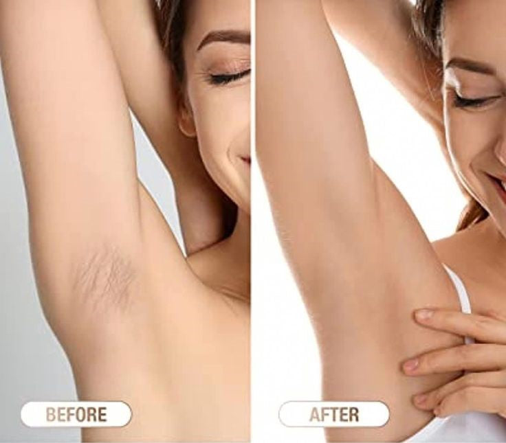 Depiladora IPL Láser – Tecnología Profesional de Depilación en Casa