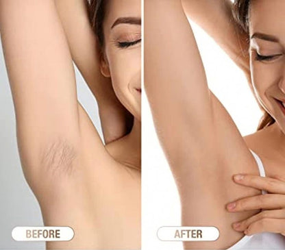 Depiladora IPL Láser – Tecnología Profesional de Depilación en Casa